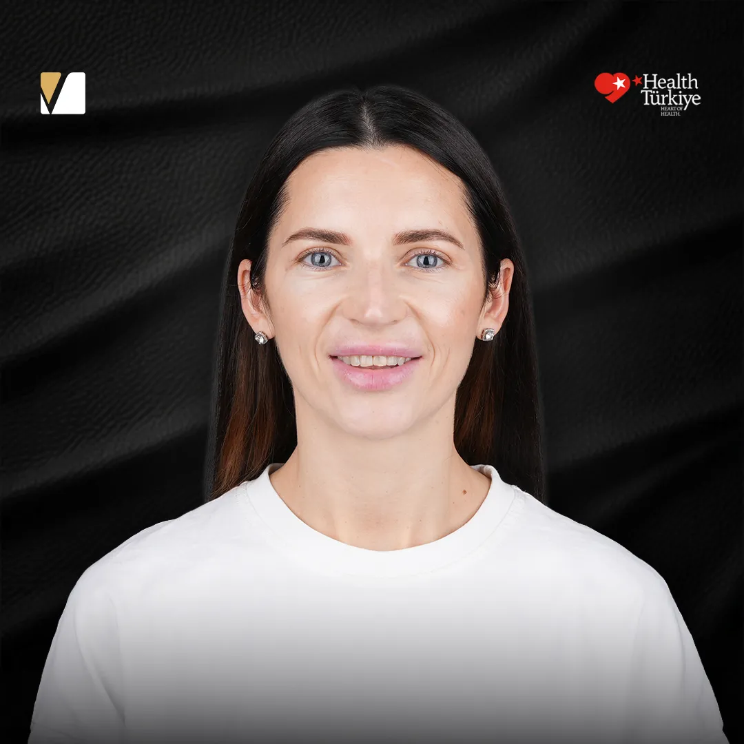 Faccette per denti discromici